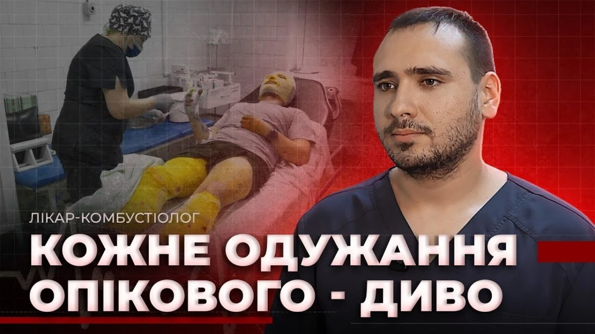 На межі болю і надії: як дніпровські лікарі рятують пацієнтів з найтяжчими опіками під час війни